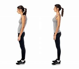 postural before and after images